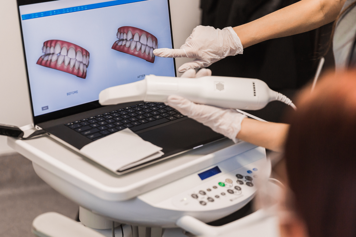 empreinte numerique dentaire Nos technologies Dr Johan Cinçon, dentiste à La Teste-de-Buch